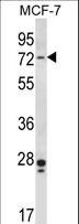 PAK4 Antibody - Mouse Pak4 Antibody western blot of MCF-7 cell line lysates (35 ug/lane). The Pak4 antibody detected the Pak4 protein (arrow).