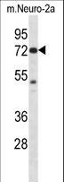 PAK4 Antibody - Mouse Pak4 Antibody western blot of Neuro-2a cell line lysates (35 ug/lane). The Pak4 antibody detected the Pak4 protein (arrow).