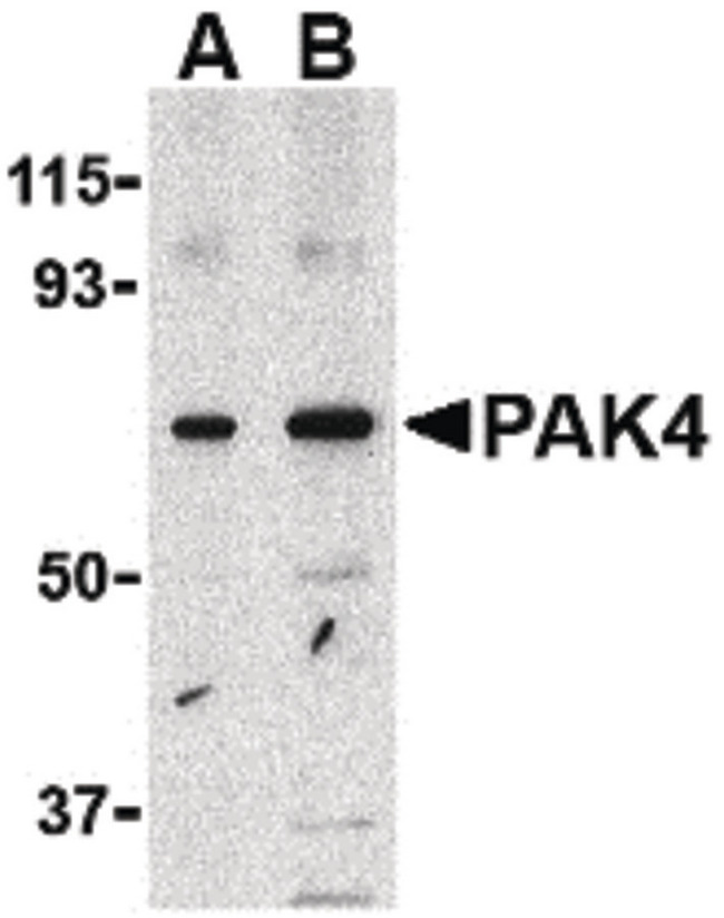 PAK4 Antibody - Western blot of PAK4 in SW480 lysate with PAK4 antibody at (A) 1 and (B) 2 ug/ml.