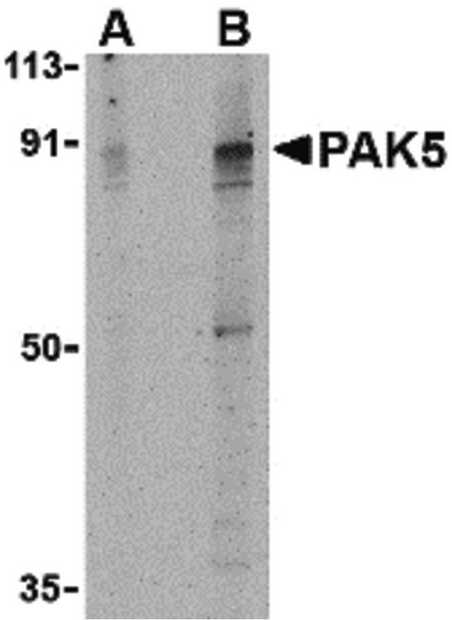 PAK7/PAK5 Antibody - Western blot of PAK5 in T24 lysate with PAK5 antibody at (A) 2 and (B) 4 ug/ml.