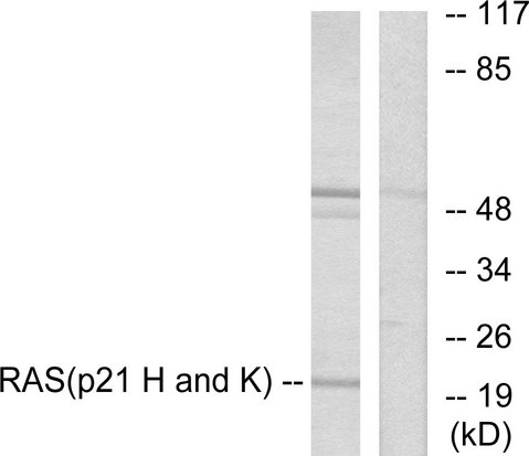 Pan Ras Antibody - Western blot analysis of lysates from HeLa cells, using RASH/RASK Antibody. The lane on the right is blocked with the synthesized peptide.