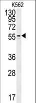 PAOX / PAO Antibody - PAOX Antibody western blot of K562 cell line lysates (35 ug/lane). The PAOX antibody detected the PAOX protein (arrow).