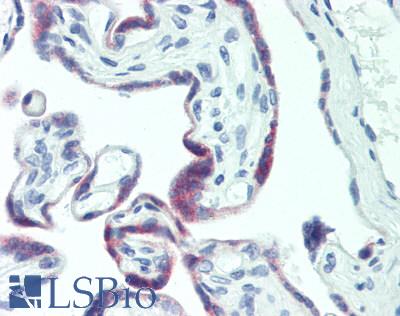 PAPPA / PAPP-A Antibody - Human Placenta: Formalin-Fixed, Paraffin-Embedded (FFPE), at a dilution of 1:100