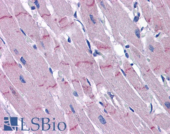 PAPPA2 / Pappalysin 2 Antibody - Anti-PAPPA2 antibody IHC of human heart. Immunohistochemistry of formalin-fixed, paraffin-embedded tissue after heat-induced antigen retrieval. Antibody concentration 5 ug/ml.