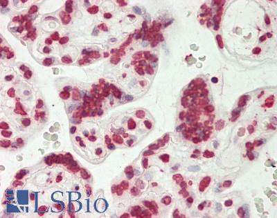 PAR / Poly ADP-Ribose Antibody - Human Placenta: Formalin-Fixed, Paraffin-Embedded (FFPE)