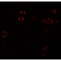Paralemmin 3 / PALM3 Antibody - Immunofluorescence of Paralemmin 3 in MCF7 cells with Paralemmin 3 antibody at 20 µg/mL.