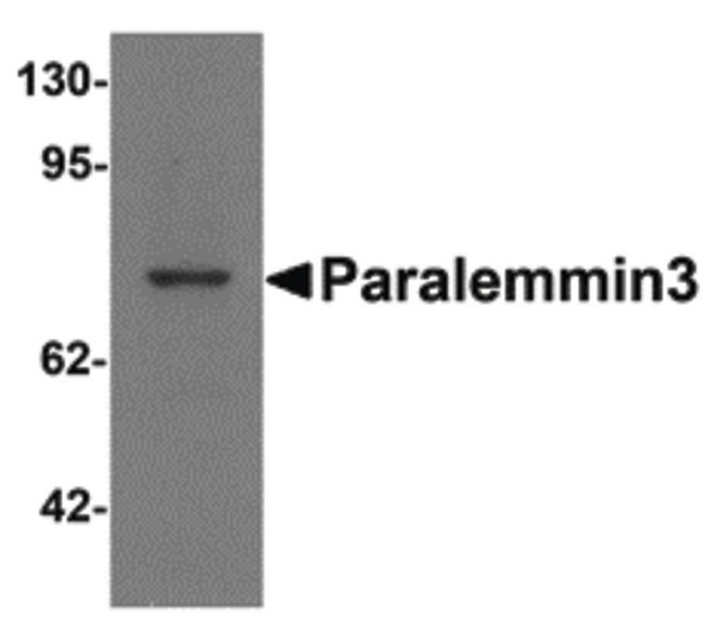 Paralemmin 3 / PALM3 Antibody - Western blot of Paralemmin3 in MCF7 cell lysate with Paralemmin3 antibody at 1 ug/ml.