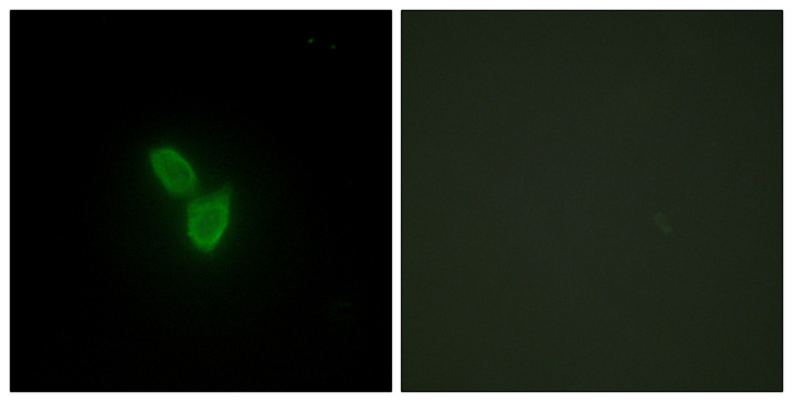 PARD3 Antibody - Immunofluorescence analysis of HepG2 cells, using PARD3 Antibody. The picture on the right is blocked with the synthesized peptide.