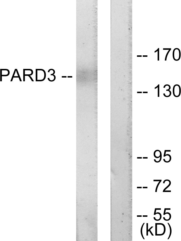 PARD3 Antibody - Western blot analysis of lysates from COLO205 cells, using PARD3 Antibody. The lane on the right is blocked with the synthesized peptide.