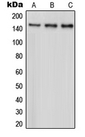PARD3 Antibody - Western blot analysis of PARD3 expression in HeLa (A); A431 (B); MCF7 (C) whole cell lysates.