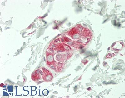 PARD3 Antibody - Human Small Intestine, Submucosal Plexus: Formalin-Fixed, Paraffin-Embedded (FFPE)