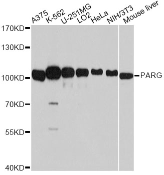 PARG Antibody - Western blot analysis of extracts of various cell lines, using PARG antibody at 1:7000 dilution. The secondary antibody used was an HRP Goat Anti-Rabbit IgG (H+L) at 1:10000 dilution. Lysates were loaded 25ug per lane and 3% nonfat dry milk in TBST was used for blocking. An ECL Kit was used for detection and the exposure time was 20s.