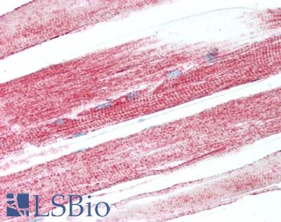 PARG Antibody - Human Skeletal Muscle: Formalin-Fixed, Paraffin-Embedded (FFPE)