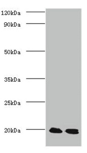 PARK7 / DJ-1 Antibody - Western blot All lanes: Protein DJ-1 antibody at 2µg/ml Lane 1: EC109 whole cell lysate Lane 2: 293T whole cell lysate Secondary Goat polyclonal to rabbit IgG at 1/15000 dilution Predicted band size: 20 kDa Observed band size: 20 kDa