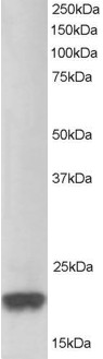 PARK7 / DJ-1 Antibody - Antibody staining (1 ug/ml) of Jurkat lysate (RIPA buffer, 30 ug total protein per lane). Primary incubated for 1 hour. Detected by Western blot of chemiluminescence.
