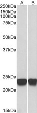 PARK7 / DJ-1 Antibody - Goat Anti-PARK7 / DJ-1 Antibody (0.001µg/ml) staining of HeLa (A) and Jurkat (B) lysates (35µg protein in RIPA buffer). Detected by chemiluminescencence.