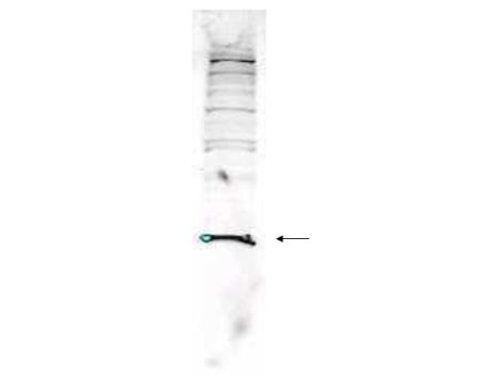 PARK7 / DJ-1 Antibody - Anti-Human PARK7 Antibody - Western Blot. Western blot analysis is shown using Affinity Purified anti-Human PARK7 antibody to detect PARK7 present in Jurkat whole cell lysate. This western blot shows reactivity with human PARK7 protein. Comparison to a molecular weight marker indicates a predominant band of ~28.0 kD. Peptide competition blocks specific reactivity of the antibody with PARK7 (not shown). A 16% Tris-Tricine gel was used to separate proteins prior to transfer to 0.2 micron nitrocellulose. The blot was incubated with a 1:1300 dilution of the antibody overnight at 4C followed by detection using IRDye800 labeled Goat-a-Rabbit IgG [H&L] ( diluted 1:5000 for 45 min at RT. IRDye800 fluorescence image was captured using the Odyssey Infrared Imaging System developed by LI-COR. IRDye is a trademark of LI-COR, Inc. Other detection systems will yield similar results.