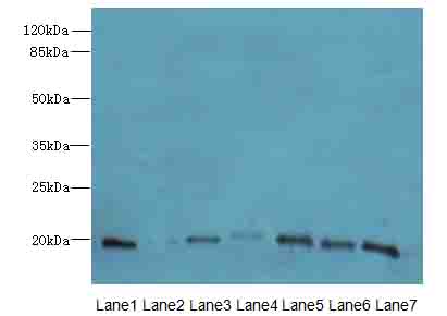 PARK7 / DJ-1 Antibody - Western blot. All lanes: PARK7 antibody at 5 ug/ml. Lane 1: HeLa whole cell lysate. Lane 2: 293T whole cell lysate. Lane 3: Jurkat whole cell lysate. Lane 4: SH-SY5Y whole cell lysate. Lane 5: Mouse brain tissue. Lane 6: Mouse liver tissue. Lane 7: Mouse heart tissue. Secondary Goat polyclonal to Rabbit IgG at 1:10000 dilution. Predicted band size: 20 kDa. Observed band size: 20 kDa.