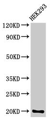 PARK7 / DJ-1 Antibody - Western Blot Positive WB detected in: HEK293 whoel cell lysate All lanes: PARK7 antibody at 3.4µg/ml Secondary Goat polyclonal to rabbit IgG at 1/50000 dilution Predicted band size: 20 kDa Observed band size: 20 kDa