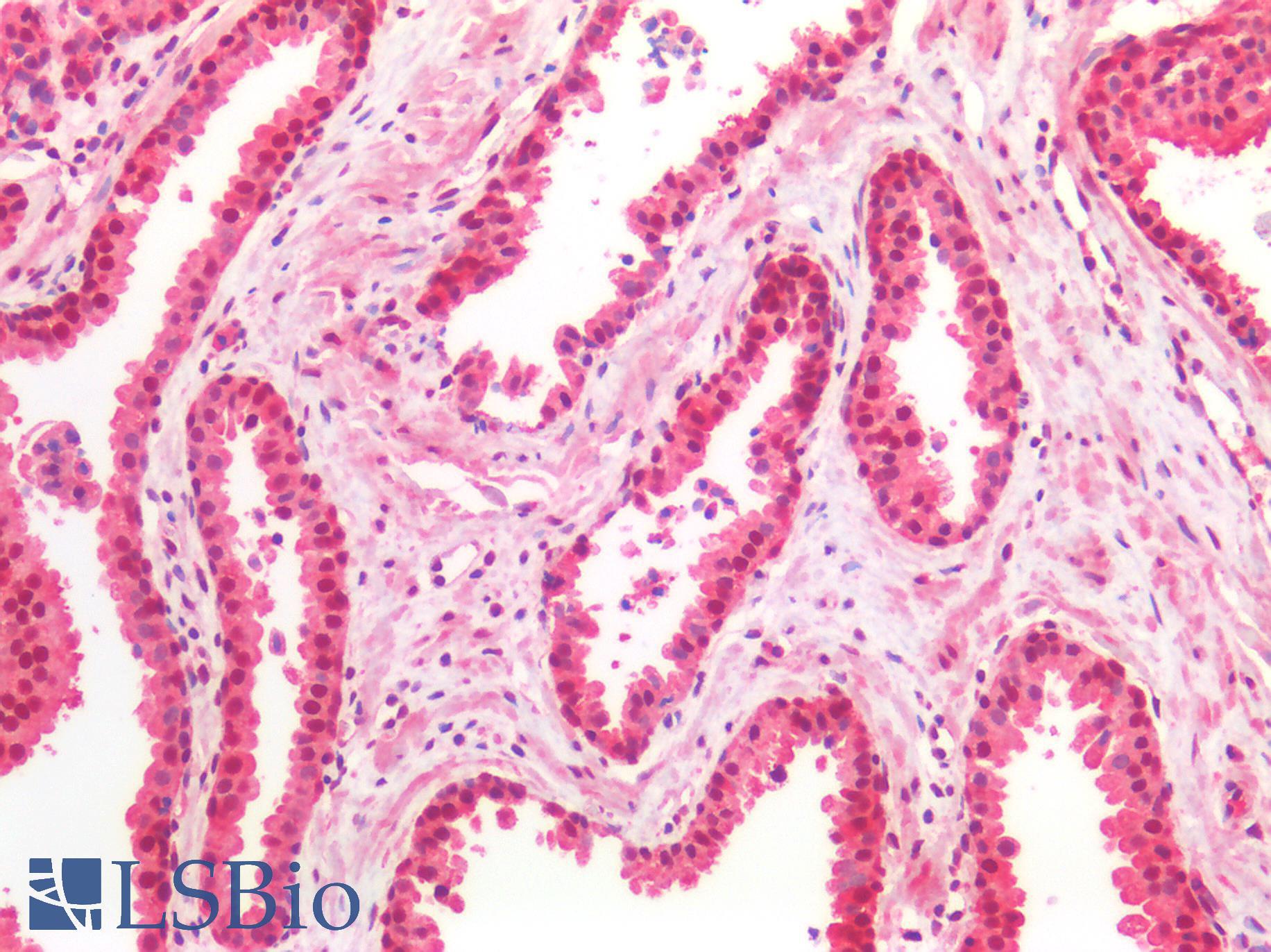 PARK7 / DJ-1 Antibody - Human Prostate: Formalin-Fixed, Paraffin-Embedded (FFPE)