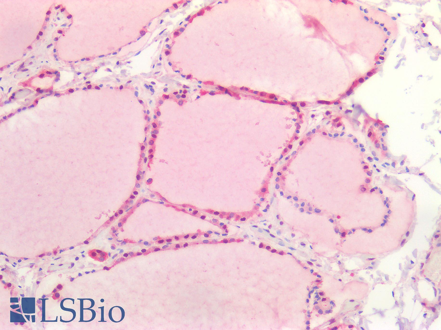 PARK7 / DJ-1 Antibody - Human Thyroid: Formalin-Fixed, Paraffin-Embedded (FFPE)