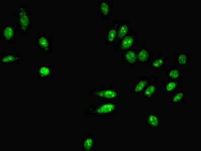 PARN Antibody - Immunofluorescent analysis of Hela cells using PARN Antibody at dilution of 1:100 and Alexa Fluor 488-congugated AffiniPure Goat Anti-Rabbit IgG(H+L)
