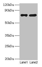 PARN Antibody - Western blot All lanes: Poly (A) -specific ribonuclease PARN antibody at 2µg/ml Lane 1: Jurkat whole cell lysate Lane 2: A431 whole cell lysate Secondary Goat polyclonal to rabbit IgG at 1/10000 dilution Predicted band size: 74, 67, 68, 53 kDa Observed band size: 74 kDa