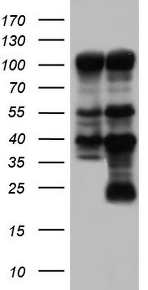 PARP1 Antibody - HEK293T cells were transfected with the pCMV6-ENTRY control (Left lane) or pCMV6-ENTRY PARP1 (Right lane) cDNA for 48 hrs and lysed. Equivalent amounts of cell lysates (5 ug per lane) were separated by SDS-PAGE and immunoblotted with anti-PARP1.