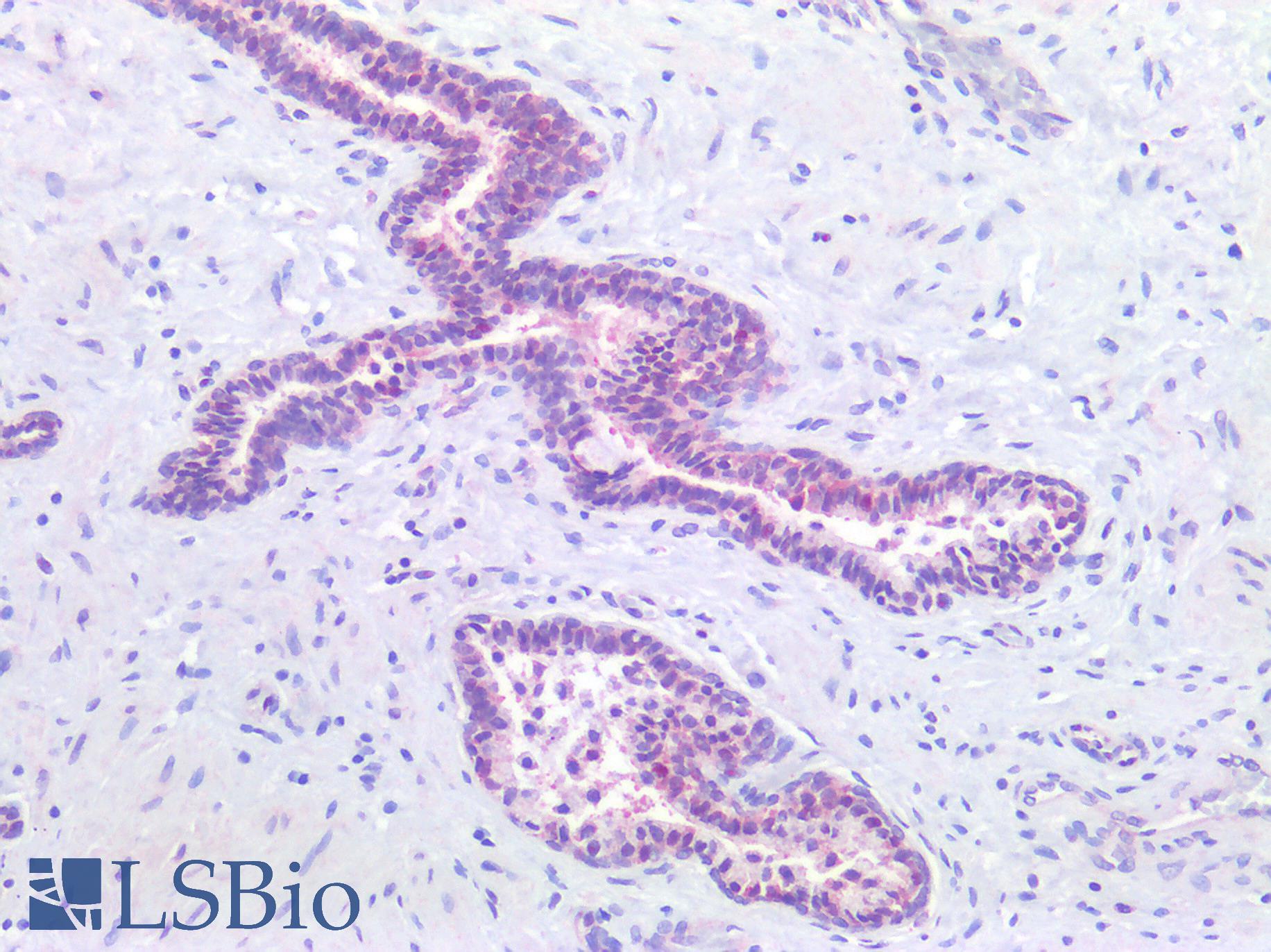 PARP1 Antibody - Human Prostate: Formalin-Fixed, Paraffin-Embedded (FFPE)