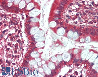 PARP4 / VPARP Antibody - Human Small Intestine: Formalin-Fixed, Paraffin-Embedded (FFPE), at a dilution of 1:100.