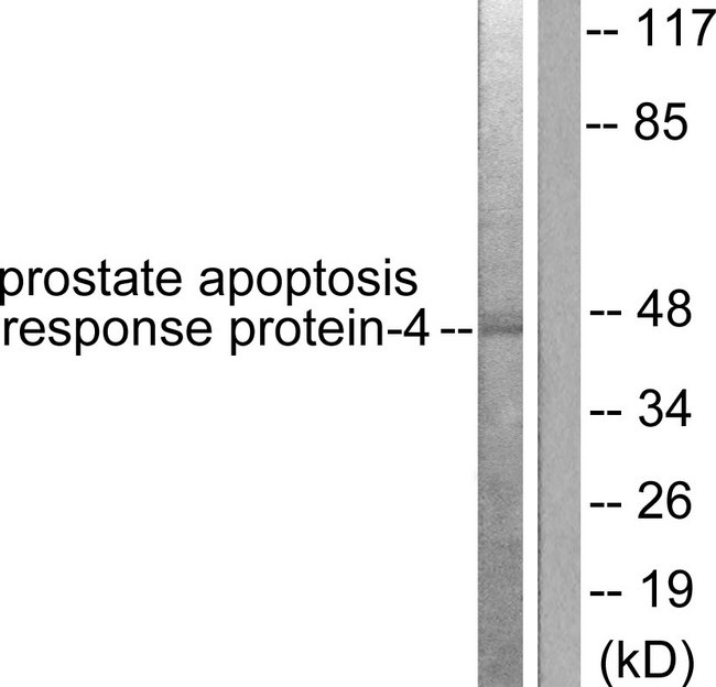 PAWR / PAR4 Antibody - Western blot analysis of lysates from NIH/3T3 cells, using Prostate Apoptosis Response protein-4 Antibody. The lane on the right is blocked with the synthesized peptide.