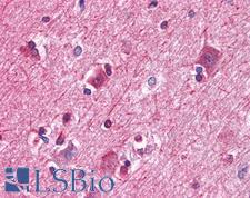 PAWR / PAR4 Antibody - Anti-PAWR / PAR4 antibody IHC of human brain, cortex. Immunohistochemistry of formalin-fixed, paraffin-embedded tissue after heat-induced antigen retrieval. Antibody dilution 1:200.