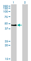 PAX2 Antibody - Western blot of PAX2 expression in transfected 293T cell line by PAX2 monoclonal antibody clone 3C7.