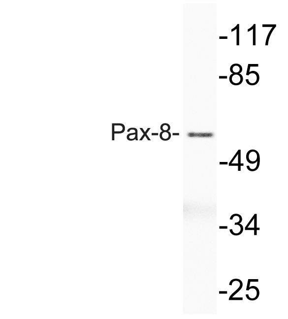 PAX8 Antibody - Western blot analysis of lysate from HT-29 cells, using Pax-8 antibody.