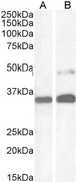 PAX8 Antibody - PAX8 antibody (1µg/ml) staining of Human Kidney (A) and HeLa cell (B) lysate (35µg protein in RIPA buffer). Detected by chemiluminescence.