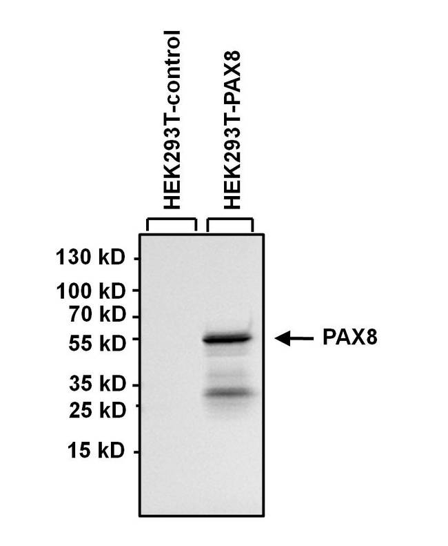 PAX8 Antibody - WB using PAX8 Antibody (1F8-3A8)