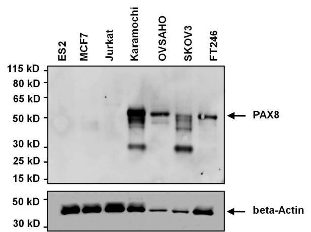 PAX8 Antibody - WB using PAX8 Antibody (1F8-3A8)
