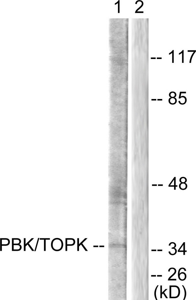 PBK / TOPK Antibody - Western blot analysis of lysates from COS7 cells, treated with Nocodazole 1ug/ml 16h, using PBK/TOPK Antibody. The lane on the right is blocked with the synthesized peptide.
