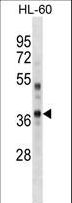 PBK / TOPK Antibody - PBK/TOPK Antibody (Mouse C-term) western blot of HL-60 cell line lysates (35 ug/lane). The PBK/TOPK antibody detected the PBK/TOPK protein (arrow).