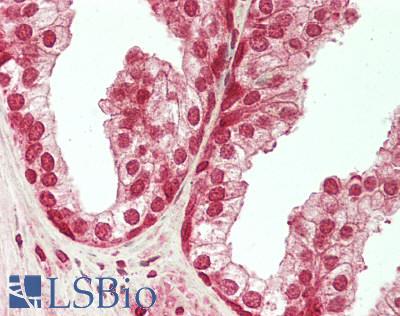 PBRM1 / BAF180 / PB1 Antibody - Human Prostate: Formalin-Fixed, Paraffin-Embedded (FFPE)
