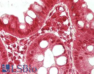 PBRM1 / BAF180 / PB1 Antibody - Human Colon: Formalin-Fixed, Paraffin-Embedded (FFPE)