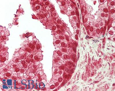 PBRM1 / BAF180 / PB1 Antibody - Human Prostate: Formalin-Fixed, Paraffin-Embedded (FFPE)