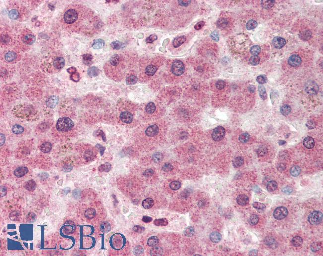 PC / Pyruvate Carboxylase Antibody - Anti-Pyruvate Carboxylase antibody IHC of human liver. Immunohistochemistry of formalin-fixed, paraffin-embedded tissue after heat-induced antigen retrieval. Antibody concentration 5 ug/ml.