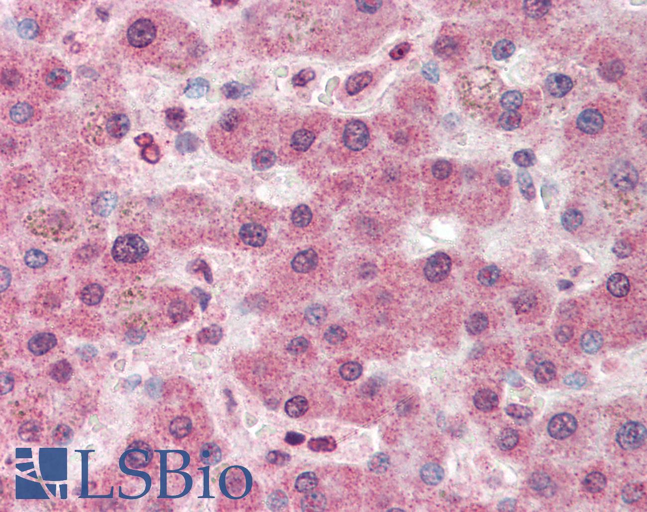 PC / Pyruvate Carboxylase Antibody - Anti-Pyruvate Carboxylase antibody IHC of human liver. Immunohistochemistry of formalin-fixed, paraffin-embedded tissue after heat-induced antigen retrieval. Antibody concentration 5 ug/ml.