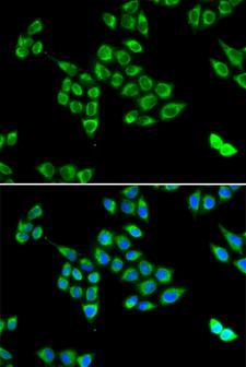 PC / Pyruvate Carboxylase Antibody - Immunofluorescence analysis of U2OS cells.