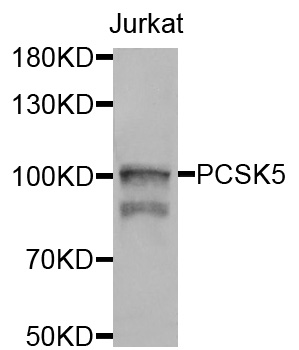 PC5 / PCSK5 Antibody - Western blot analysis of extracts of jurkat cells.