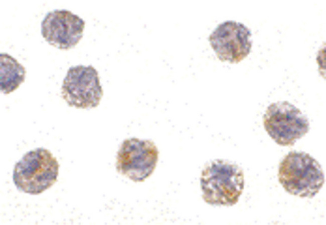 PCBP4 Antibody - Immunocytochemistry of MCG10 in HeLa cells with MCG10 antibody at 1 ug/ml.