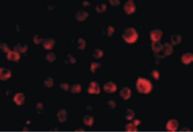 PCBP4 Antibody - Immunofluorescence of MCG10 in HeLa cells with MCG10 antibody at 20 ug/ml.
