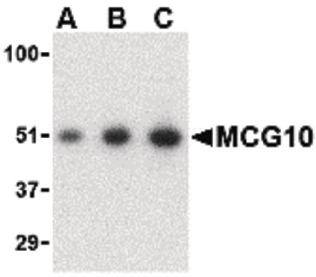 PCBP4 Antibody - Western blot of MCG10 in HeLa cell lysate with MCG10 antibody at (A) 0.5, (B) 1 and (C) 2 ug/ml.
