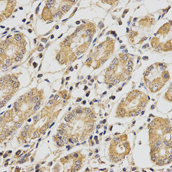 PCCB Antibody - Immunohistochemistry of paraffin-embedded human stomach using PCCB antibody at dilution of 1:200 (x400 lens).